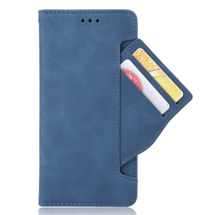 For Blackview A70 (2021) Skin Feel Calf Pattern Horizontal Flip Leather Case with Holder & Card Slots & Photo Frame(Blue) - More Brand by buy2fix | Online Shopping UK | buy2fix