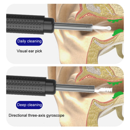 Household Visual Ear Excavator High-Definition Ear Wax Removal Picking Stick(White) - Ear Care Tools by buy2fix | Online Shopping UK | buy2fix